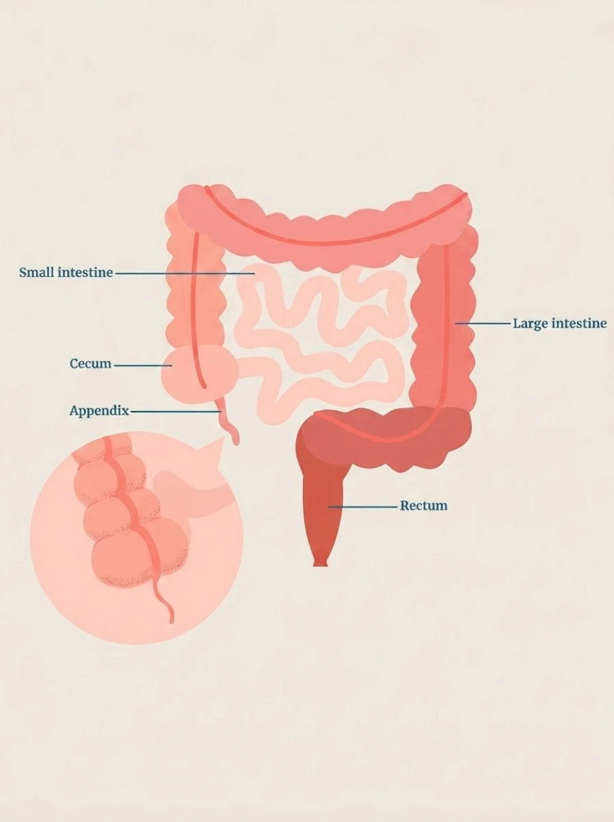 Lap appendectomy 3
